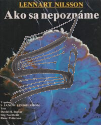 ako sa nepozname